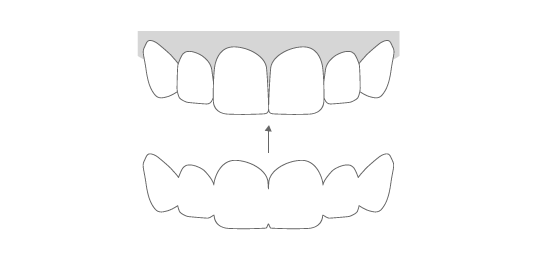 Estética dental Ortodoncia invisible