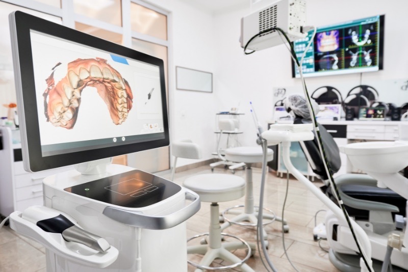 Conoce todo sobre el escáner intraoral como herramienta de diagnóstico y planificación odontológica.